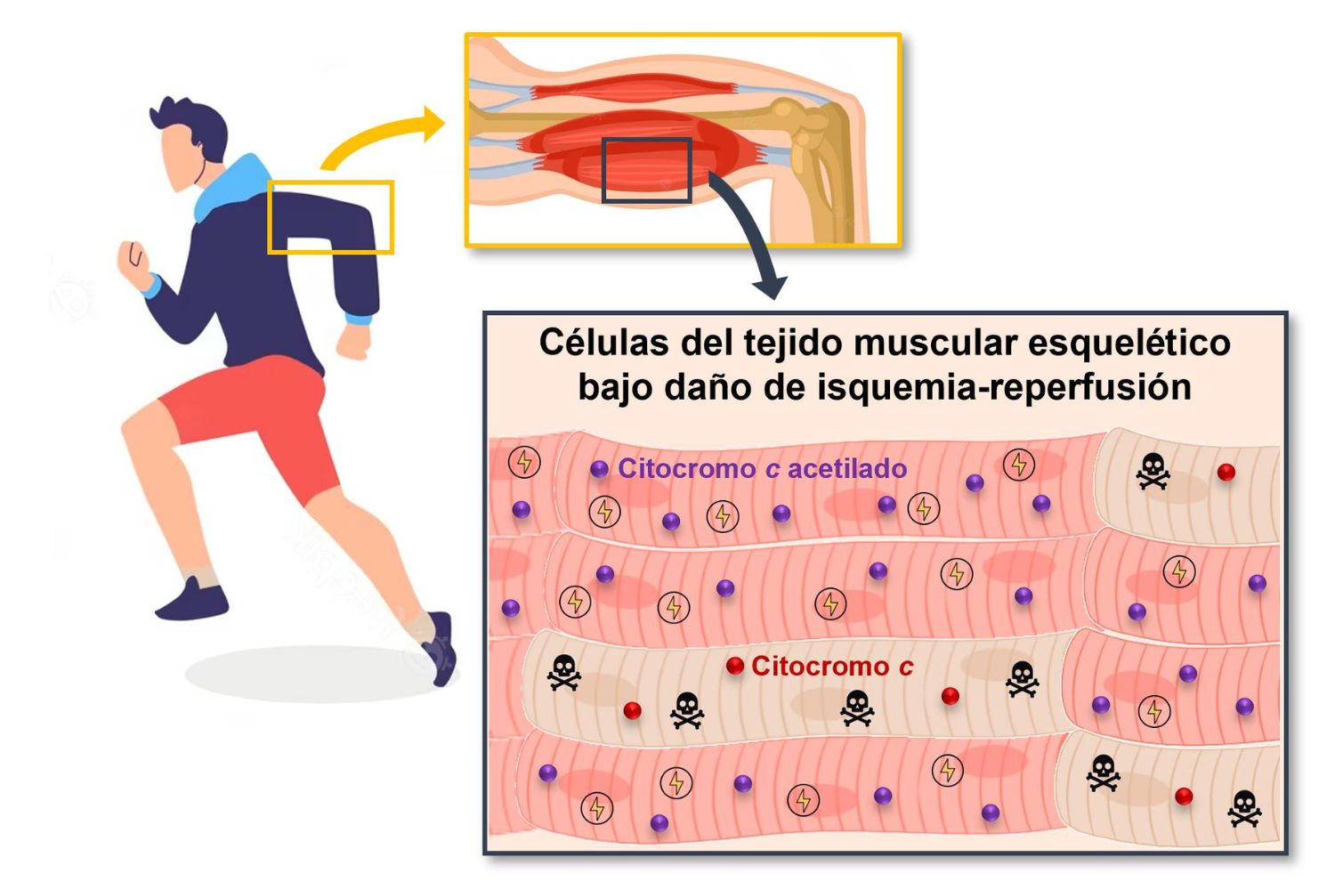 Infografía