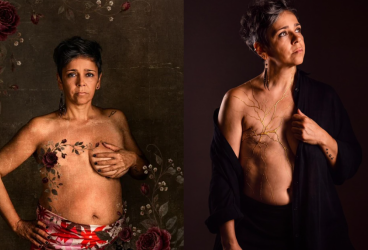 ‘Hablemos del cáncer’, una exposición fotográfica para visibilizar la enfermedad